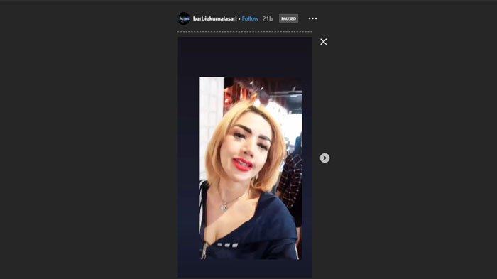 perubahan bibir Barbie Kumalasari