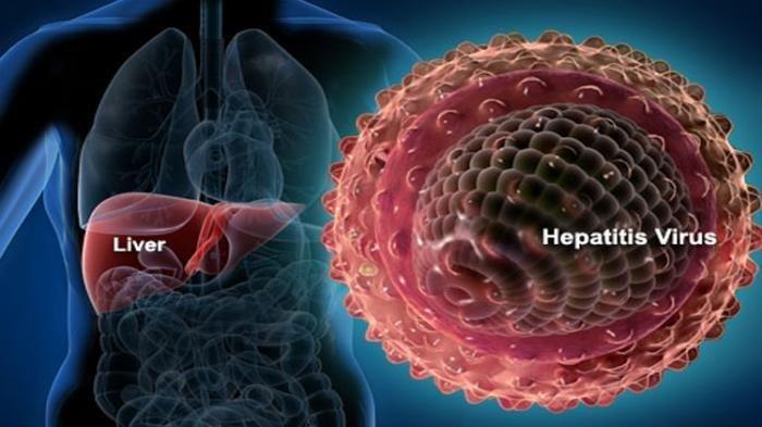 Ilustrasi Hepatitis
