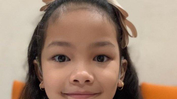 Beatrix Purba mewakili Indonesia di ajang Cochlear Got Talent tingkat Asia Pasifik setelah sebelumnya menjuarai tingkat asia tenggara dan tingkat nasional