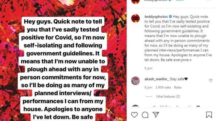 Ed Sheeran umumkan positif Covid-19, Minggu (24/10/2021).