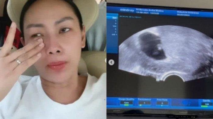 Kalina Oktarani optimis bayi di dalam kandungannya bakal bertahan.