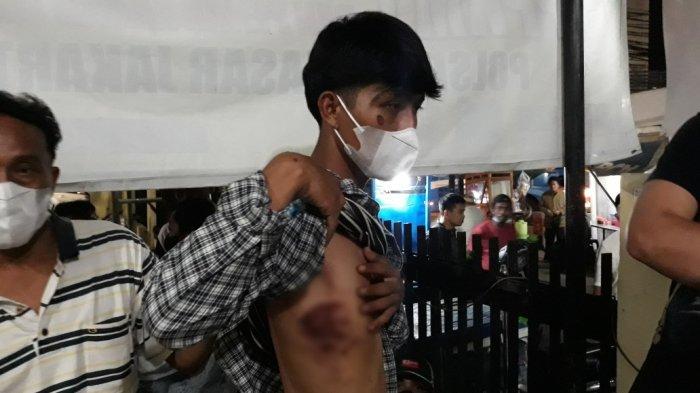 Marwan (23), anak Pipih Suherti yang menjadi korban pengeroyokan saat menunjukkan luka di Mapolsek Makasar, Jakarta Timur, Selasa (4/1/2022).