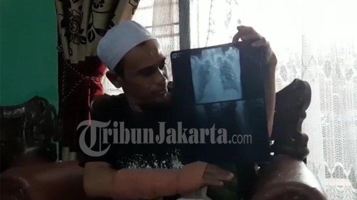 Ustaz Qomar, korban pengeroyokan belasan pemuda, memperlihatkan hasil rontgen saat ditemui wartawan di rumahnya di Jakarta Selatan, Jumat (6/5/2022).