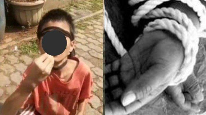 Viral bocah laki-laki tubuhnya kurus karena kelaparan dengan kaki diikat, orangtua beri alasan tak masuk akal soal kaki anaknya yang terikat.