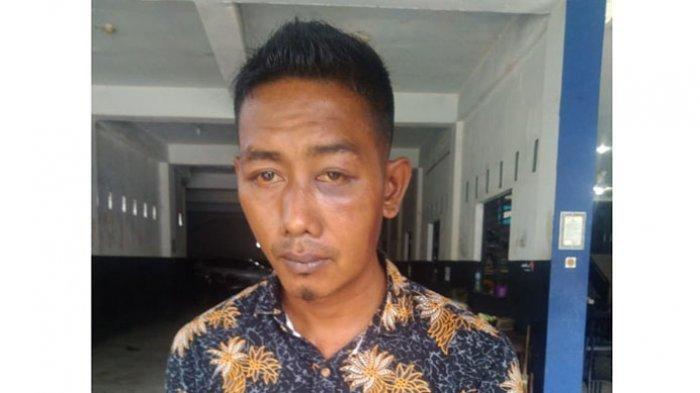 Aditya Surbakti, mantan atlet tinju Sumut menjadi korban penganiayaan saat dijumpai di Kota Medan, Senin (21/12/2020).