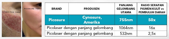 Tabel jenis Picosure