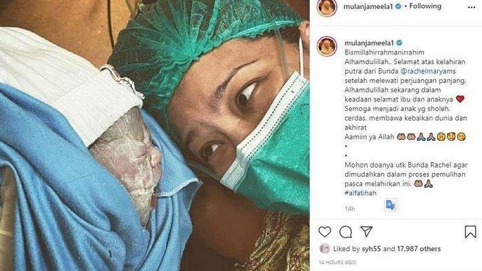 Wajah bayi Rachel Maryam ditutupi lemak putih