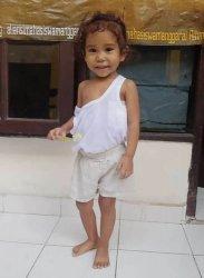 Calista, Bocah Penderita Tumor Asal Wudi Manggarai Kini Telah Dioperasi, Maria: Terima Kasih