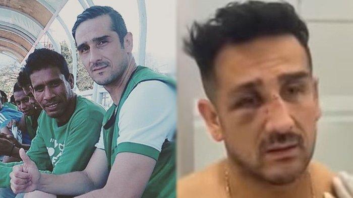 Claudio Martinez, pesepakbola sekaligus bintang sinetreon, menjadi korban kekerasan saat berada di tempat hiburan malam Basque Bar De Tapas, Setiabudi, Jakarta Selatan, Jumat (2/7/2022).