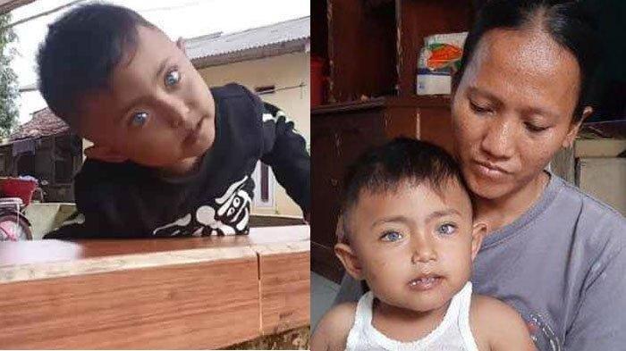 Alexi, bocah asal Desa Pondok Udik, Kecamatan Kemang, Kabupaten Bogor ini memiliki bola mata warna biru.