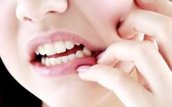 Jangan Remehkan Benjolan di Gusi! Wanita Ini Kena Kanker Tulang