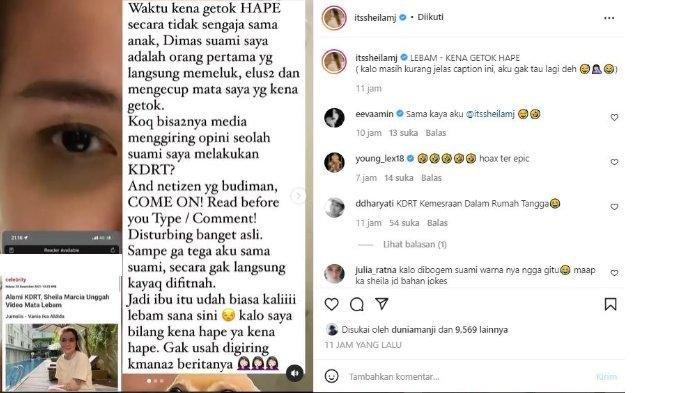 Sheila Marcia bantah alami lebam karena suami.