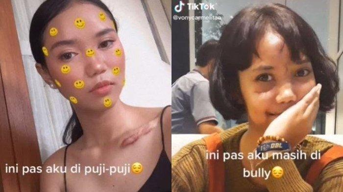 Transformasi Gadis setelah Sempat Luka Parah karena Kecelakaan.