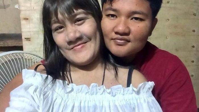 Wanita wajah berbulu lebat
