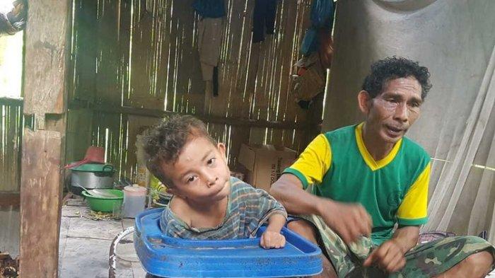 Seorang bocah sudah 7 tahun lumpuh di Manggarai Timur, NTT, Jumat, (26/11/2020).