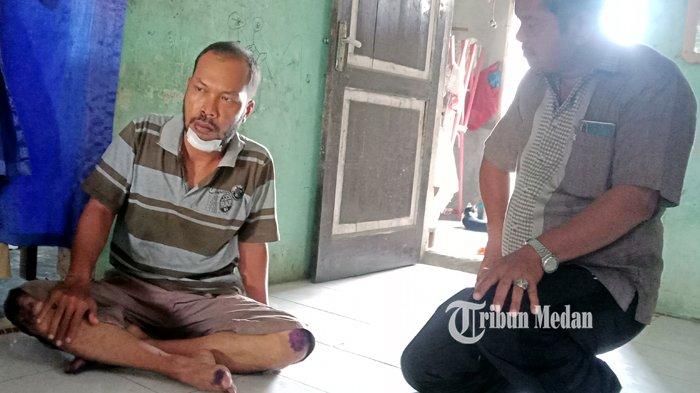 Kondisi Muhammad Nizar Lubis (38) pasca terjadi kecelakaan akibat melintasi jalan rusak dan berlubang, di ruas jalan rusak, di Jalan Pertahanan, Desa Sigara-Gara, Patumbak, Deliserdang, Sumatera Utara, Selasa (16/3/2021). Akibat kecelakaan tersebut Nizar mengalami luka sobek di bagian dagu sehingga mendapati delapan jahitan dan mengalami pergeseran tulang rahang.TRIBUN MEDAN/RISKI CAHYADI
