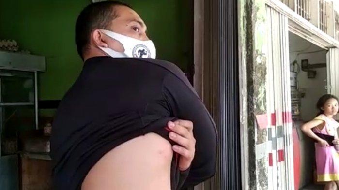 Pemilik warung makan yang diserang preman di Kota Medan mengalami luka bakar