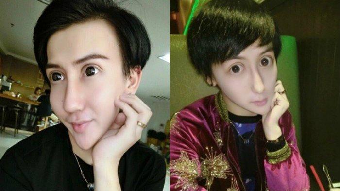 Ingat si 'Pria Berwajah Ular' yang Viral 6 Tahun Lalu? Tiba-tiba Muncul Bawa Kabar Mengejutkan