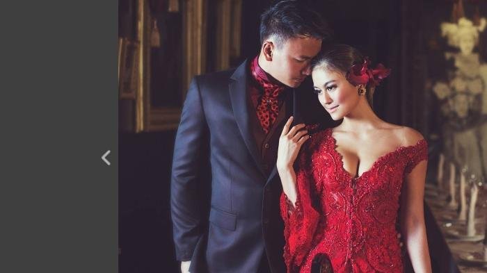Pasangan selebriti Wijaya Saputra dan Agnez Mo.