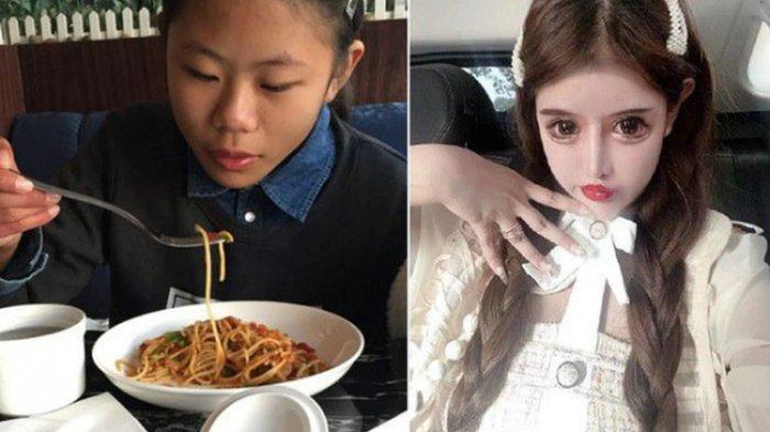 Zhou Chuna, selebgram ketagihan operasi plastik di usianya 16 tahun