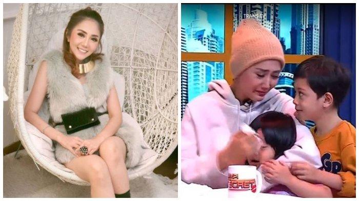 Artis Aida Saskia sebelum (kiri) dan sesudah sakit (kanan)