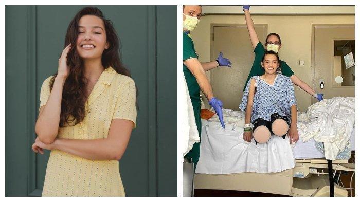 Claire Bridges harus kehilangan kedua kakinya karena komplikasi Covid-19