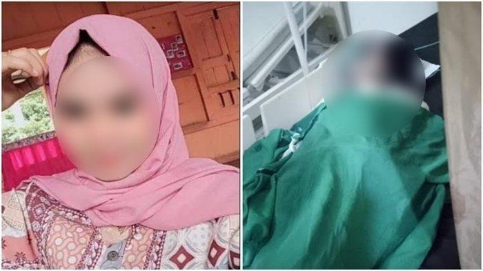 (KIRI) Foto korban saat sebelum kejadian dan (KANAN) Korban saat mendapatkan perawatan setelah dibakar oleh Brigpol Andriansyah.
