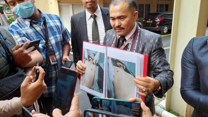 Kamaruddin Simanjuntak, penasihat hukum keluarga Samuel Hutabarat menunjukkan foto jasad Brigadir Nofriansyah Yosua Hutabarat alias Brigadir J, di Bareskrim Mabes Polri, Senin (18/7/2022). Kamaruddin menuding pelaku secara bersama-sama merencanakan pembunuhan Yosua.