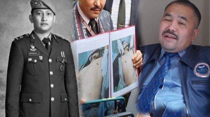 Kuasa hukum keluarga Brigadir J, Kamaruddin Simanjuntak vokal cari keadilan