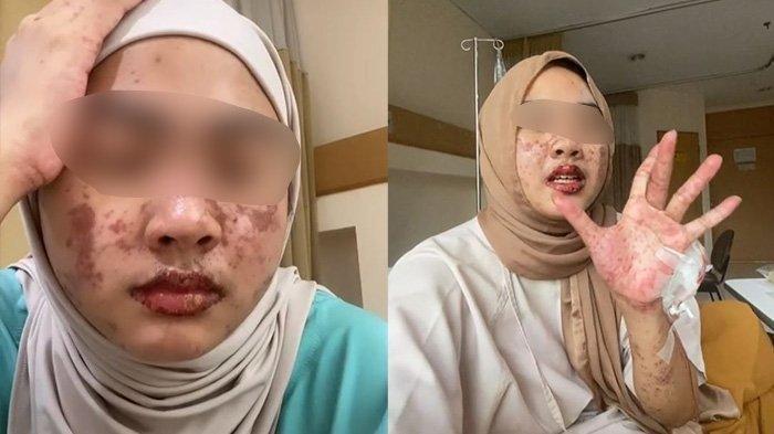 Kisah haru Afina viral di media sosial