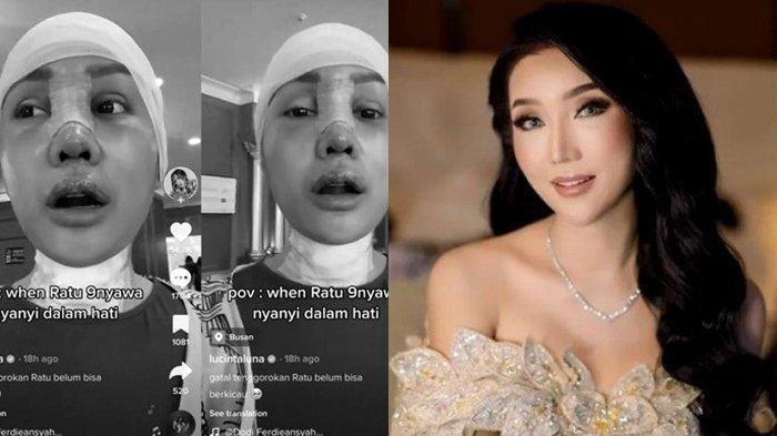 Lucinta Luna akan Lakukan Operasi Ganti Kulit