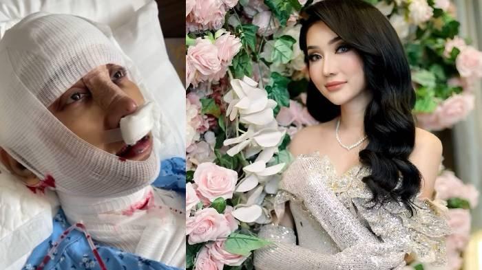 Lucinta Luna operasi pemotongan leher di Korea, untuk hilangkan suara pria?