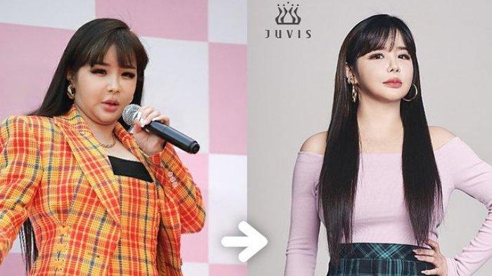 Park Bom berhasil turunkan berat badan hingga 11 kilogram.