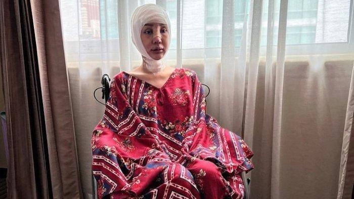Penampilan Lucinta Luna setelah operasi pemotongan leher