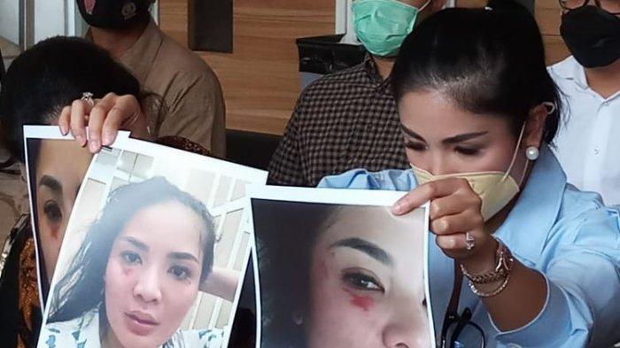 Nindy Ayunda tunjukkan bukti alami KDRT
