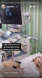 Lesti di USG