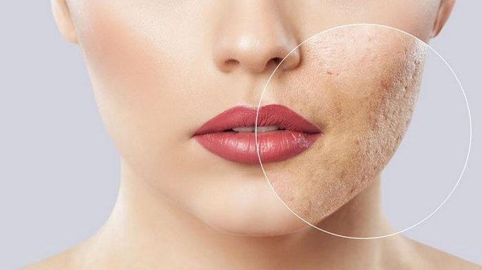 Ilustrasi seorang wanita yang mempunyai tekstur wajah yang tidak halus.