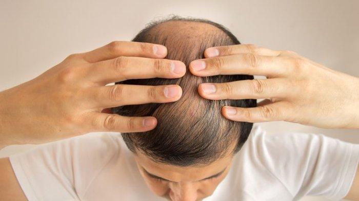 Rambut dapat mengalami kerontokan secara mendadak karena rentan mengalami uban akibat faktor umur yang semakin menua, uban ketika dibiarkan terlalu lama dapat membahayakan rambut.