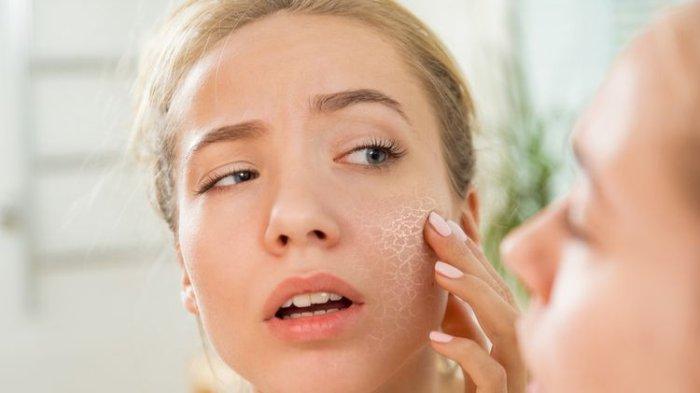 Udara yang terlalu kering bisa berpengaruh pada kondisi kulit, penggunaan humidifier di ruangan bisa jadi salah satu solusi