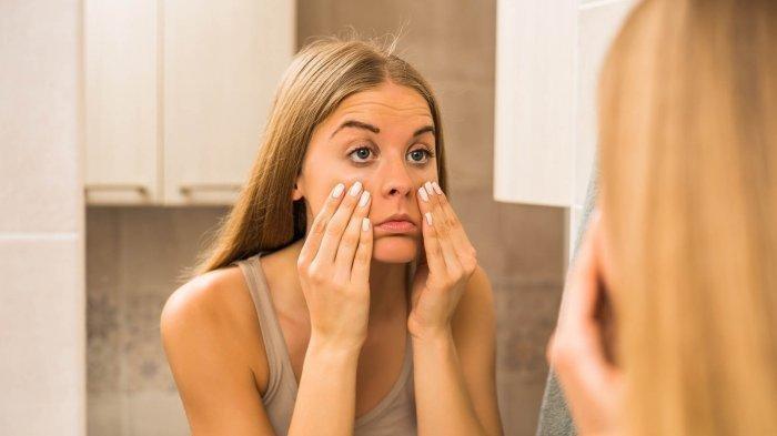 Ilustrasi perempuan yang memiliki kantung mata dan bisa dihilangkan dengan cara sederhana menggunakan masker kunyit.