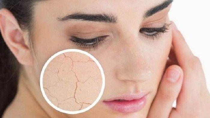 Ilustrasi perempuan yang memiliki kulit kering karena berbagai faktor penyebab