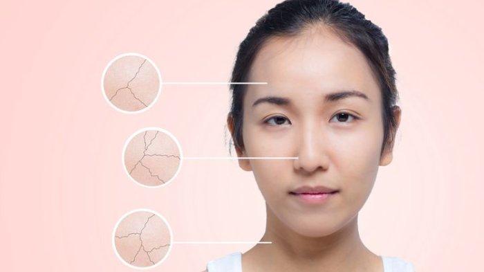 Ilustrasi kulit wajah kering yang harus berhati-hati dalam memilih produk skincare termasuk toner wajah agar tidak terjadi break out.