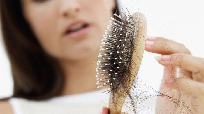 Ilustrasi wanita yang memiliki masalah rambut rontok