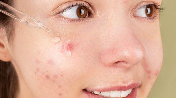 Ilustrasi wanita yang menggunakan produk skincare dengan kandungan fragrance, bisa memperparah kondisi kulit yang break out