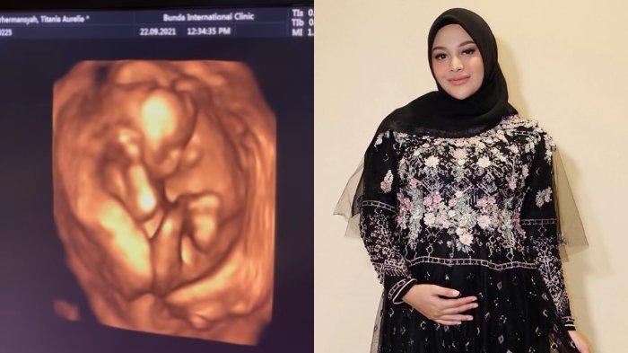 Aurel Hermansyah siapkan nama panggilan baru jika kelak sudah menjadi ibu