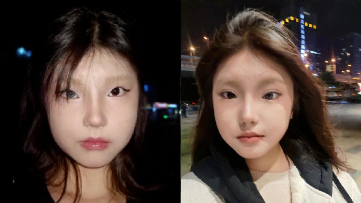 Gadis memiliki dua mata beda warna