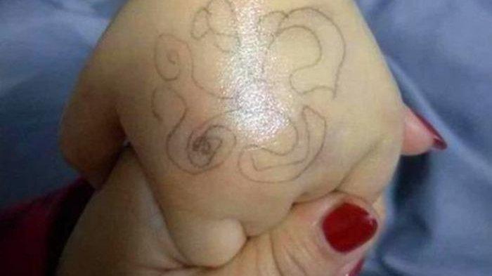 Gambar aneh ditemukan di tangan seorang gadis kecil.