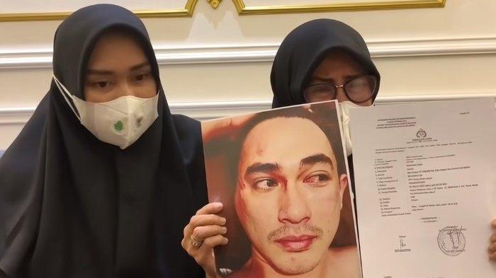 Septia Yetri Opani istri Putra Siregar punya bukti kuat Rico Valentino dikeroyok di luar cafe