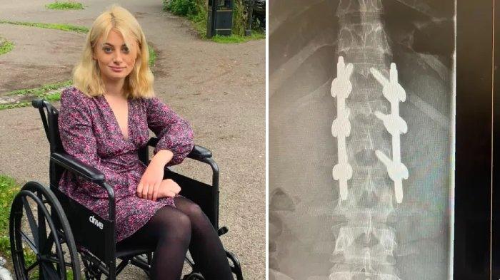 Libby Sinden, wanita yang alami patah tulang belakang setelah lompat dari jembatan ke sungai