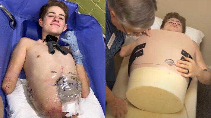 Loren Schauers jalani operasi hemicorporectomy untuk menyelamatkan jiwanya.